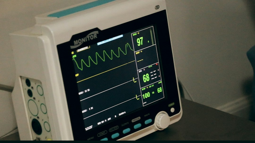 Electrocardiogram trace on graph paper, illustrating heart rhythm analysis